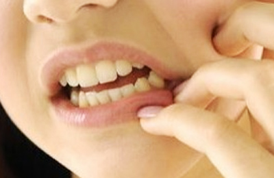 突發(fā)性、自發(fā)性的劇烈牙疼