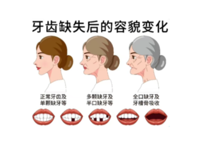 【科學(xué)科普】十個(gè)常用的口腔小知識(shí)！