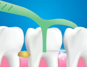 口腔問題可能要“命”！5大預警信號，別忽視