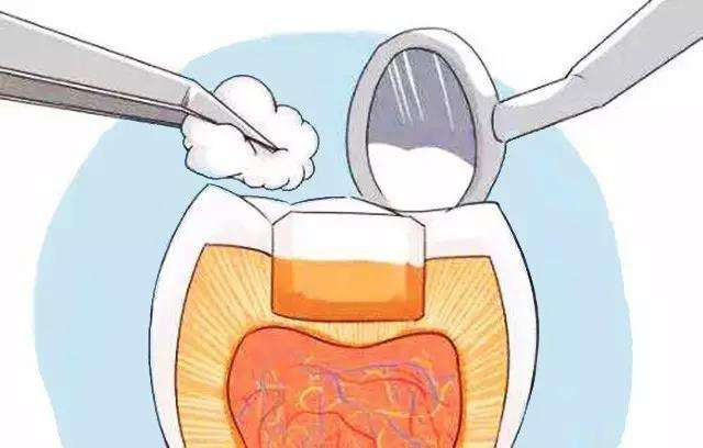 惟德口腔淺析在承德孩子牙齒蛀牙補(bǔ)牙需要多少錢